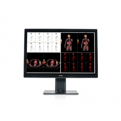 Màn hình y tế Barco MDCC-6530