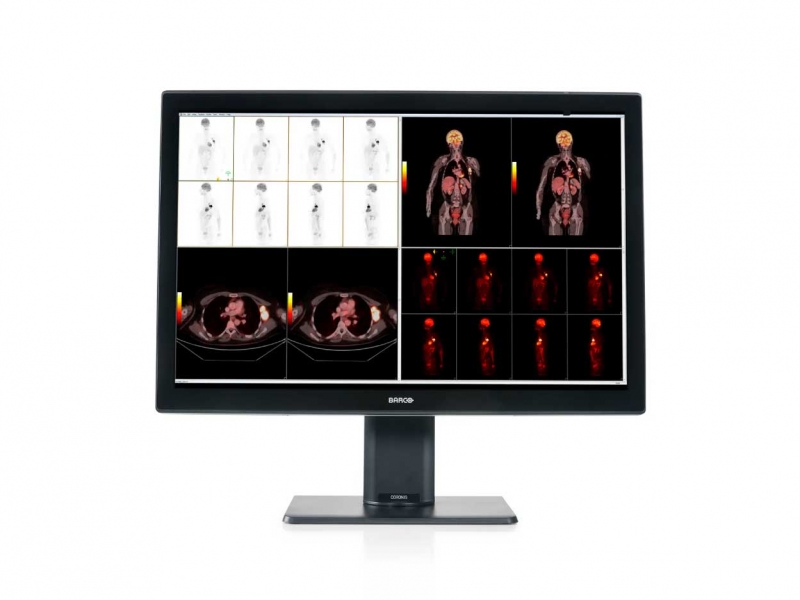 Màn hình y tế Barco MDCC-6530